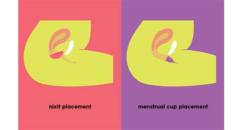 Menstrual Disc: Your A to Z Beginner Guide